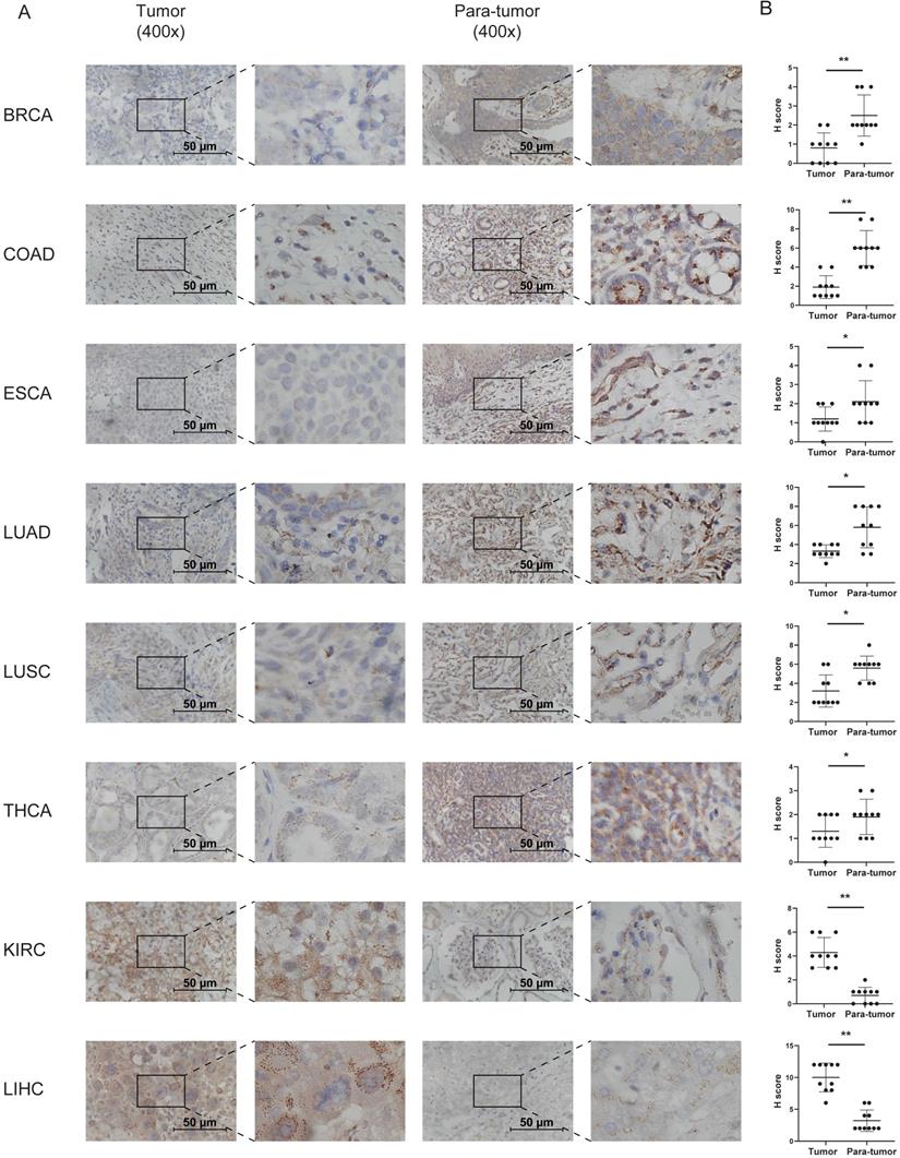 J Cancer Image