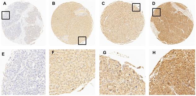 J Cancer Image