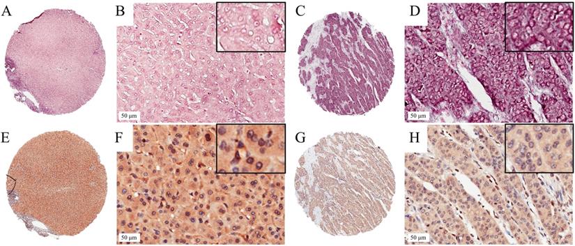 J Cancer Image