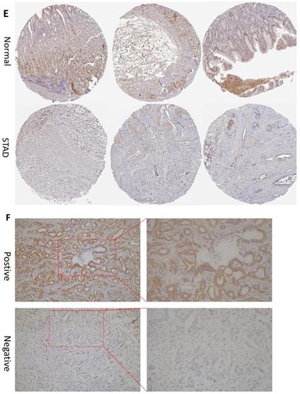 J Cancer Image