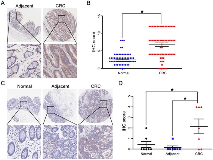 J Cancer Image