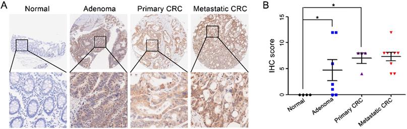 J Cancer Image