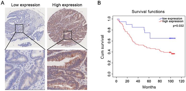 J Cancer Image