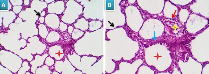 J Cancer Image