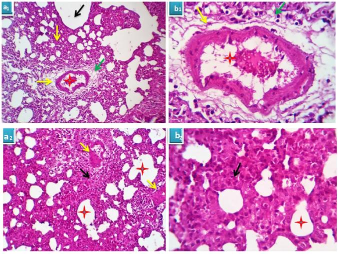 J Cancer Image