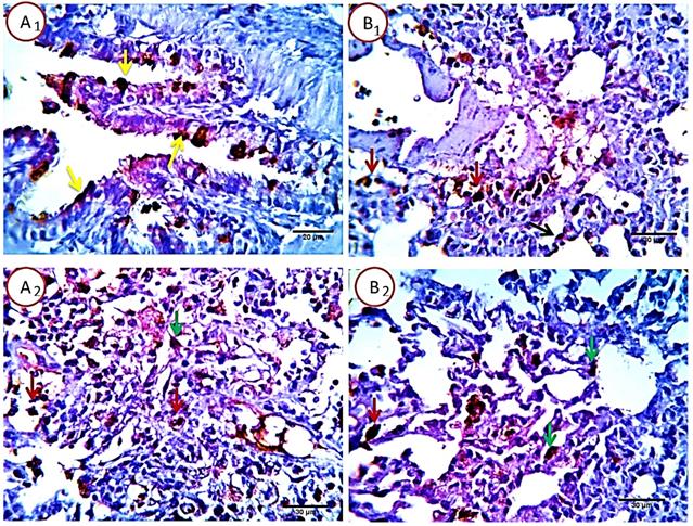 J Cancer Image