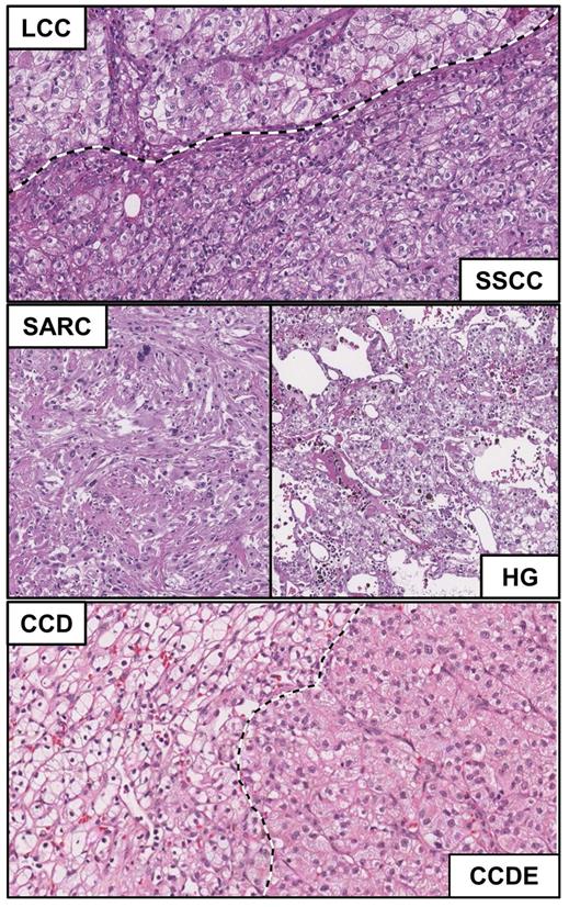 J Cancer Image