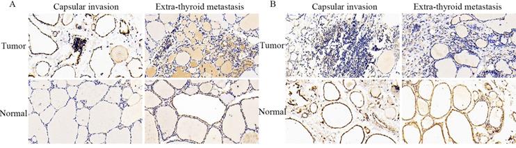 J Cancer Image