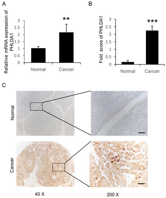 J Cancer Image