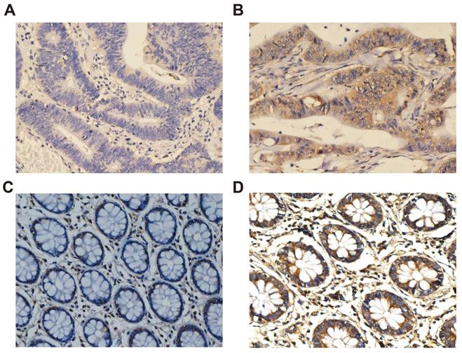 J Cancer Image