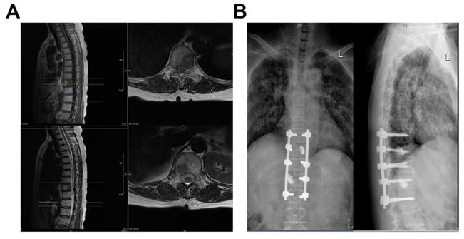 J Cancer Image