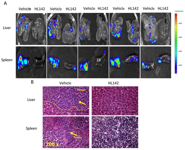 J Cancer Image