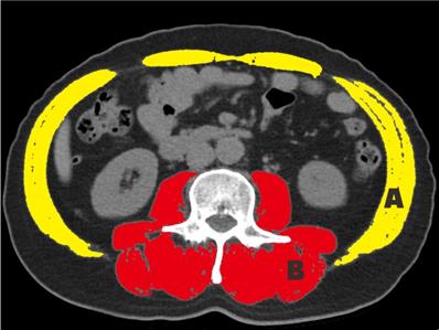 J Cancer Image