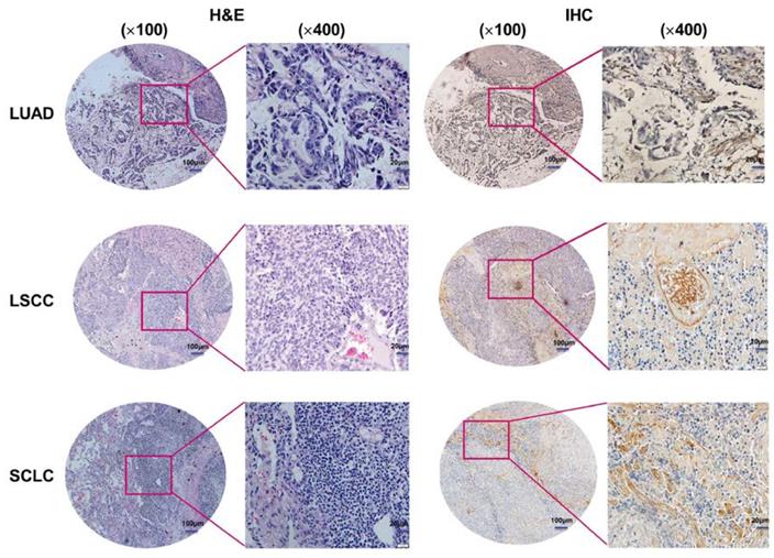 J Cancer Image