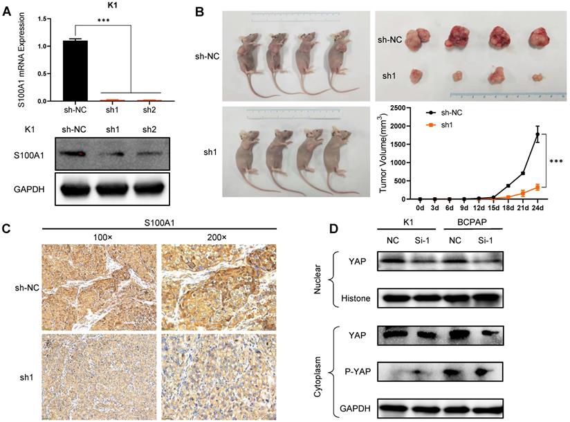 J Cancer Image