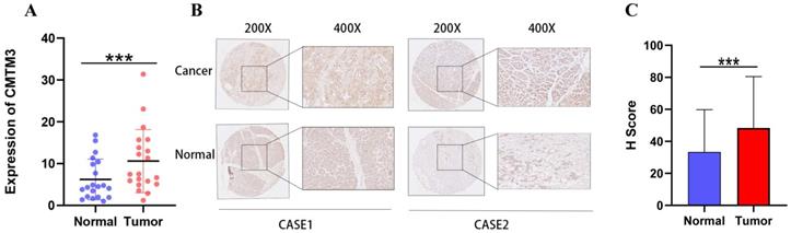 J Cancer Image