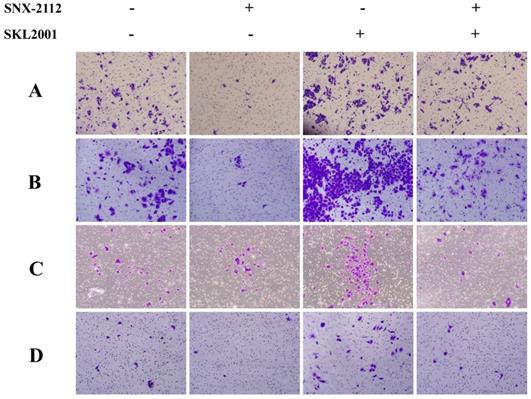 J Cancer Image