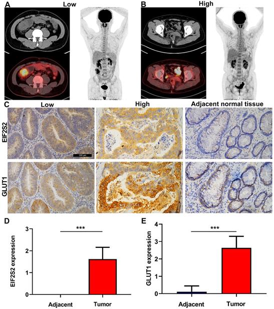 J Cancer Image