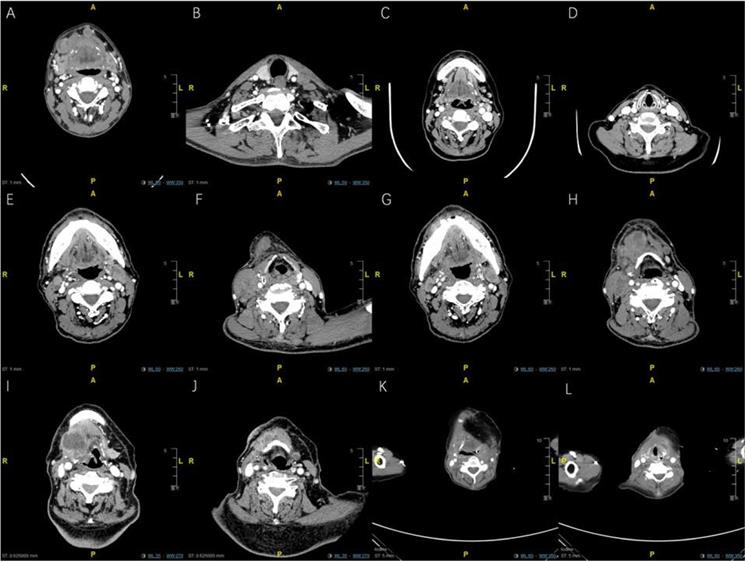 J Cancer Image