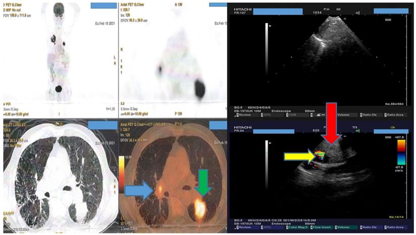 J Cancer Image