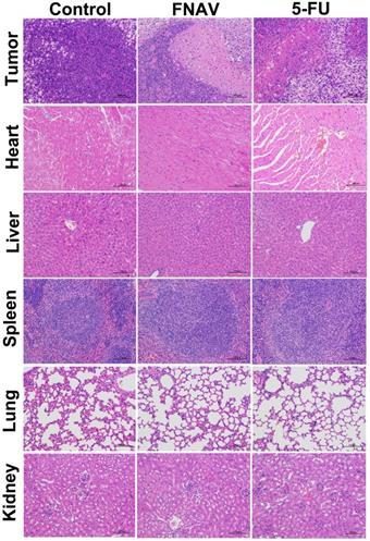 J Cancer Image