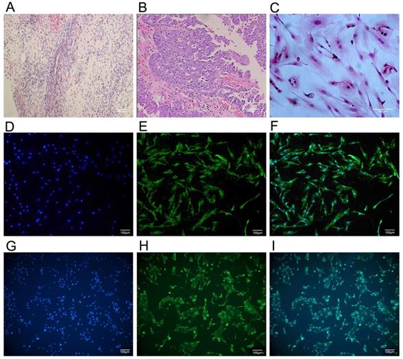 J Cancer Image