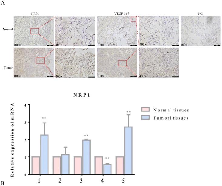 J Cancer Image