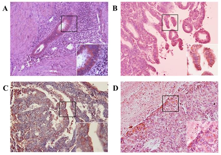 J Cancer Image