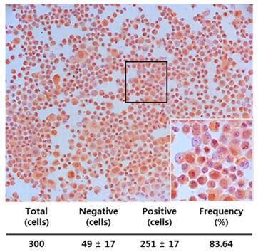 J Cancer Image