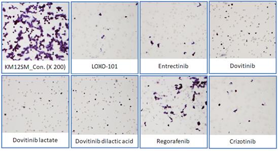 J Cancer Image