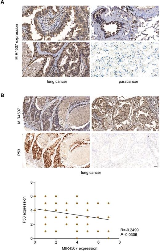 J Cancer Image