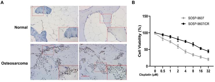 J Cancer Image