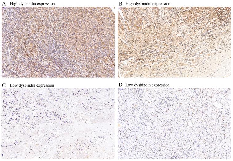 J Cancer Image