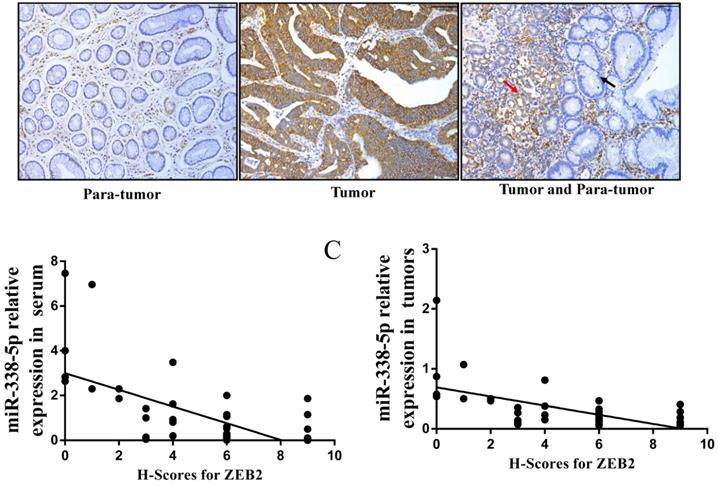 J Cancer Image