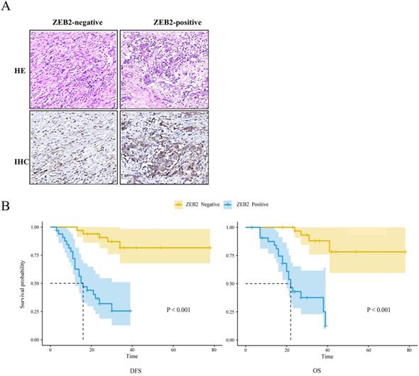 J Cancer Image