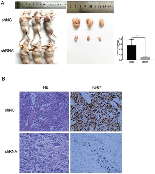 J Cancer Image