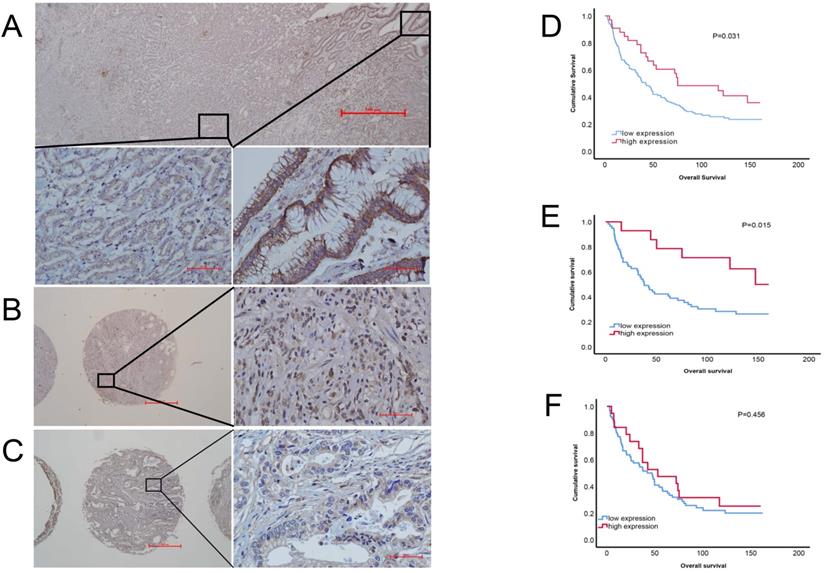 J Cancer Image