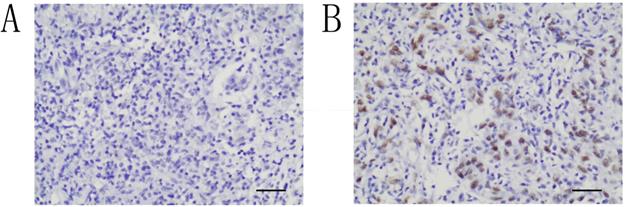 J Cancer Image