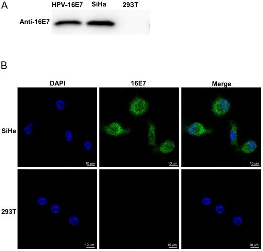 J Cancer Image