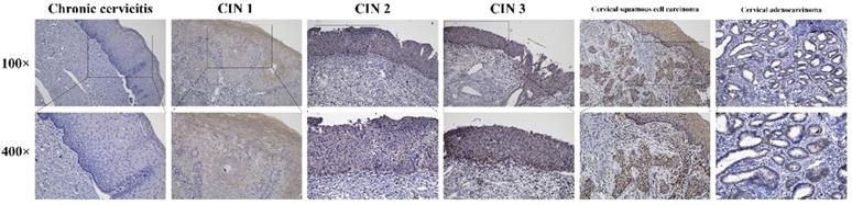 J Cancer Image