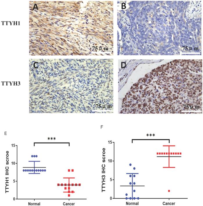 J Cancer Image