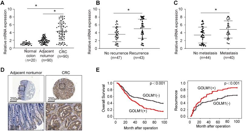 J Cancer Image