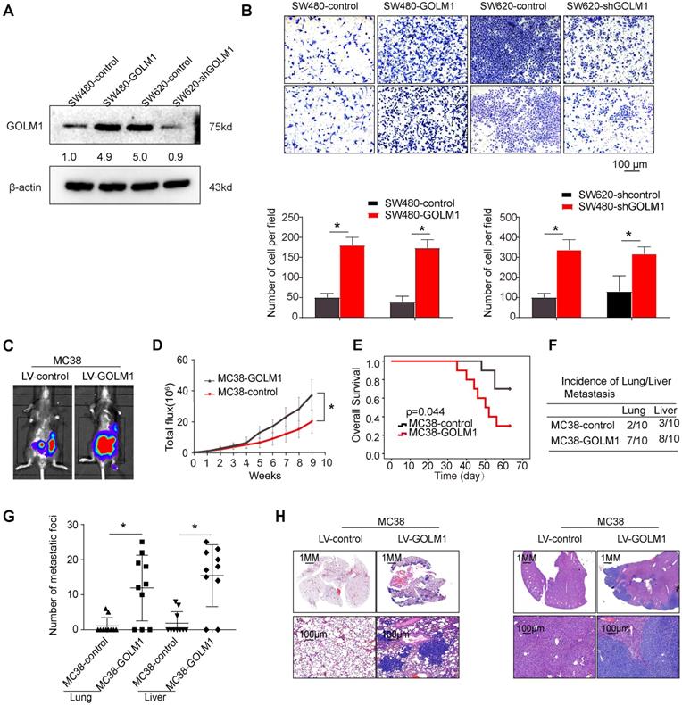 J Cancer Image