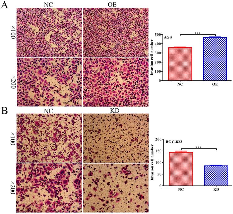 J Cancer Image