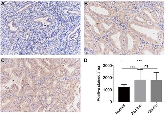 J Cancer Image