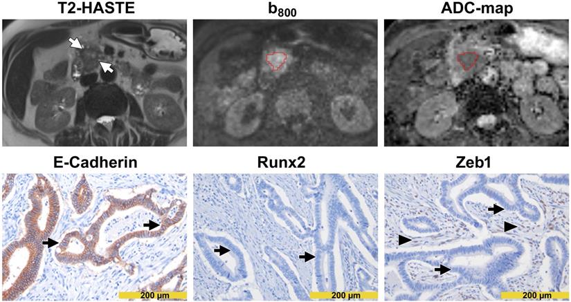 J Cancer Image