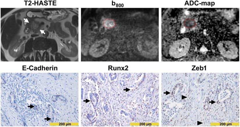 J Cancer Image