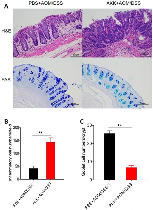 J Cancer Image