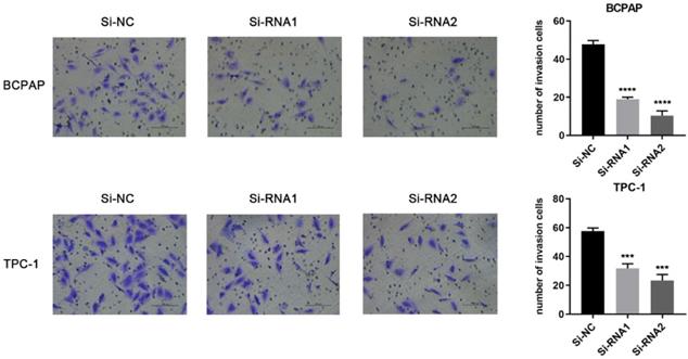 J Cancer Image