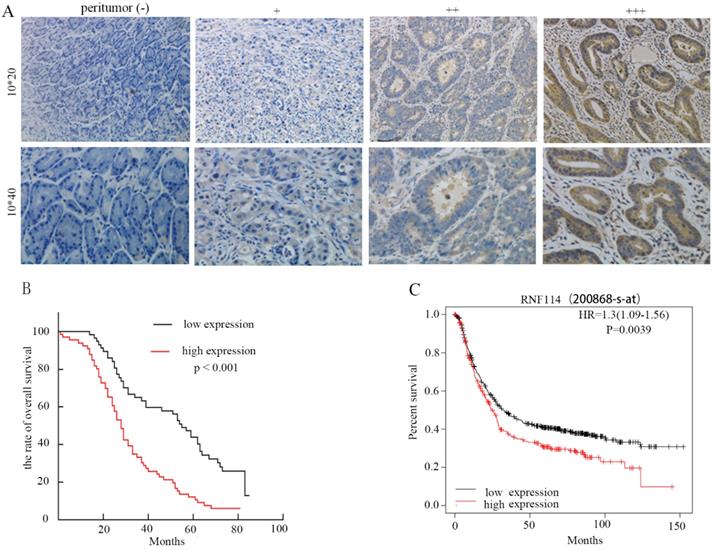 J Cancer Image